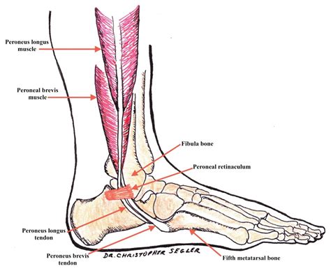 Peroneal Tendon Subluxation - DOC