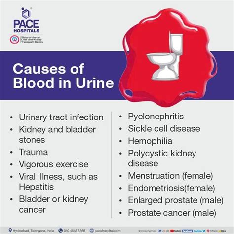 Understanding Hematuria: What Causes Blood Clots in Urine and When to Seek Help - Flash Uganda Media