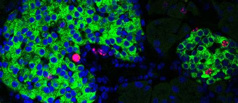 Circadian rhythms drive beta cell regeneration