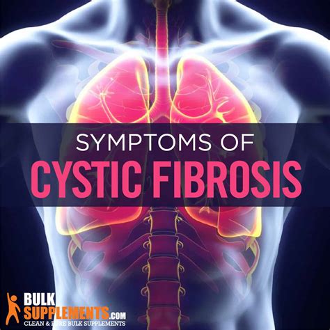 Cystic Fibrosis: Symptoms, Causes & Treatment