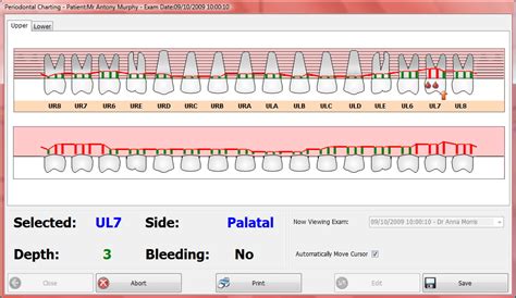 Perio Charting - Shire Dental System. Software for UK Dental Practices