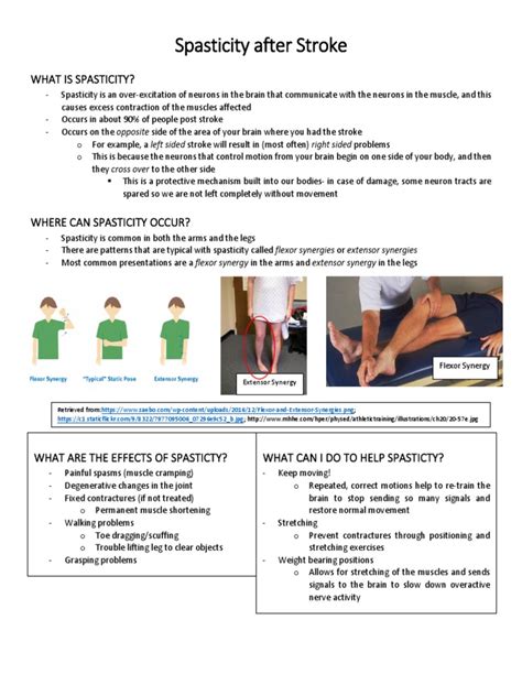 spasticity after stroke 1 | Dance Science | Neurological Disorders