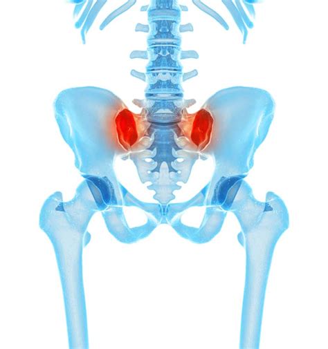 Sacroiliac Joint Injections - Personal Injury Medical Experts | Lien Based Doctors | Universal Care