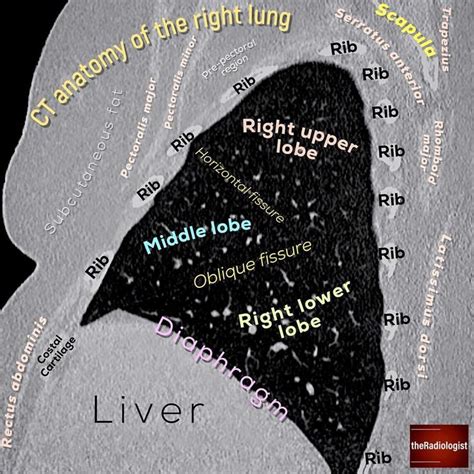 Pin em Radiology Anatomy