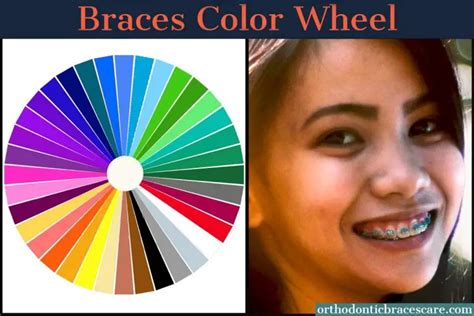 Braces Color Wheel and Ideas - Orthodontic Braces Care