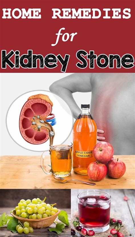 Home Remedies for Kidney Stone Home Remedies for Kidney Stone | Kidney stones remedy, Turmeric ...