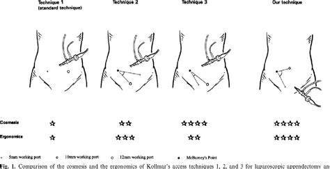 periumbilical hernia | Semantic Scholar