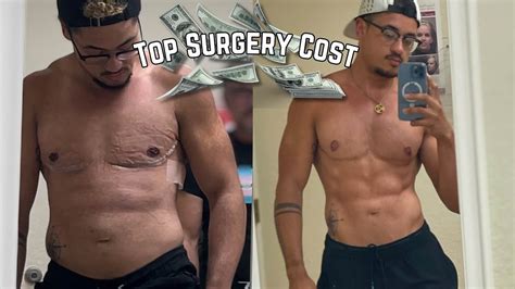 FTM Top surgery total cost ! - YouTube