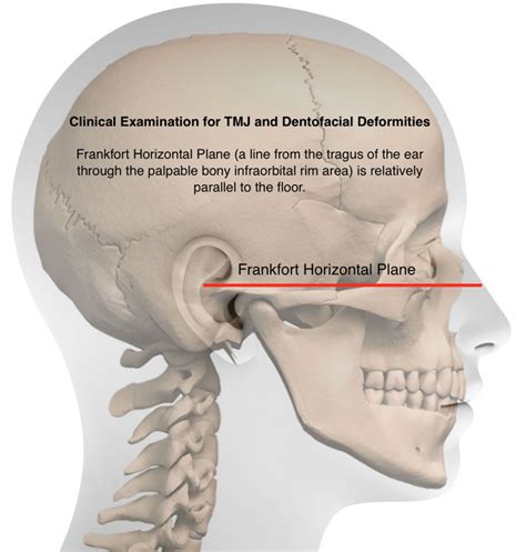 Patient Evaluation for TMJ and Dentofacial Abnormalities