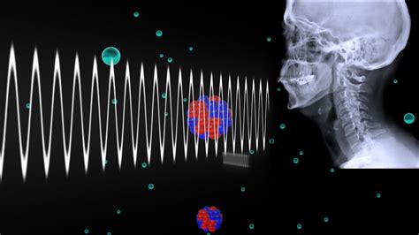 How Do X-rays Work? - YouTube