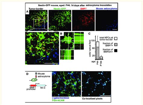 Endogenous neural precursor cells accumulate at experimental brain... | Download Scientific Diagram