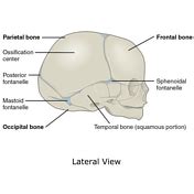 Lambdoid suture | Radiology Reference Article | Radiopaedia.org
