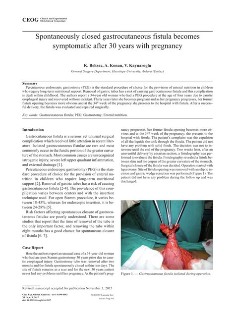 (PDF) Spontaneously closed gastrocutaneous fistula becomes symptomatic after 30 years with pregnancy