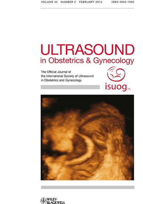 Sonographic diagnosis of lateral asynclitism: a new subtype of fetal head malposition as a main ...