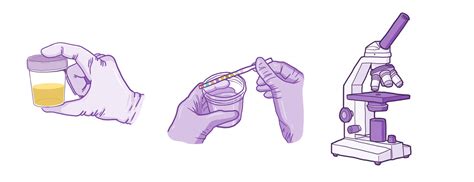 Collecting a urine specimen: Clinical skills notes | Osmosis