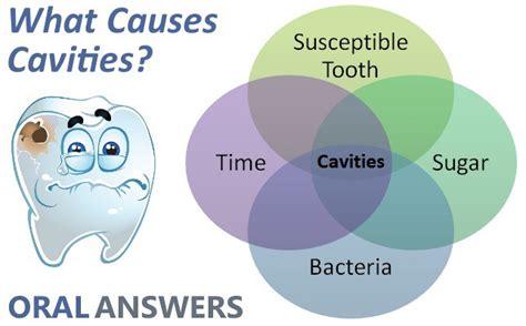 DENTAL CARIES : PREVENTION & TREATMENT