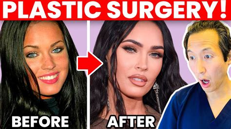 MEGAN FOX Plastic Surgery Transformation- Cosmetic Surgeon Reacts ...