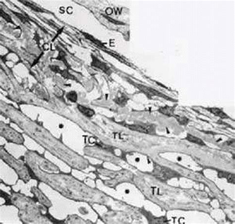 Trabecular Meshwork Anatomy