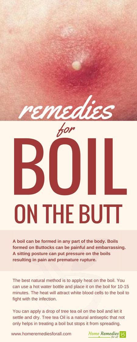 9 Boils remedies ideas | boil remedies, remedies, boil