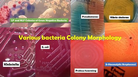 Common bacteria colony morphology and their Gram staining | Common bacteria, Gram negative ...