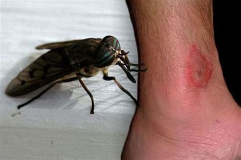 How to treat a horsefly bite as heatwave threatens to spark 'infestation' - Lincolnshire Live