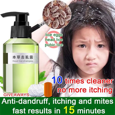 100mL lice remover shampoo Licealiz Head Lice Treatment Shampoo treatment lice remover shampoo ...