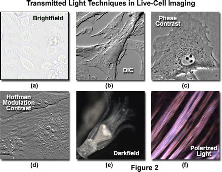 ZEISS Microscopy Online Campus | Live-Cell Imaging | Microscopy Techniques