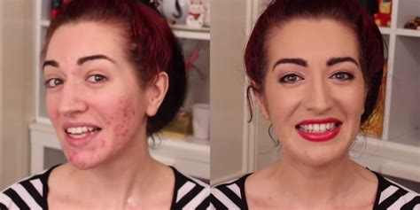 How to Cover Up Acne Scars With Makeup - Makeup Tutorial