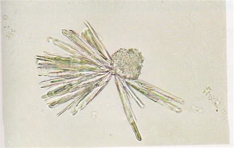 Cristaux urinaires | Massart Santé - Matériel médical et de laboratoire