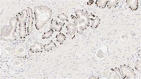 p63 Protein - IHC Primary Antibodies