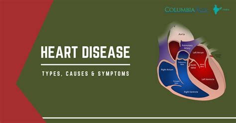 Heart Disease: Types, Causes and symptoms