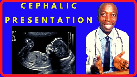 CEPHALIC PRESENTATION LESSON - YouTube