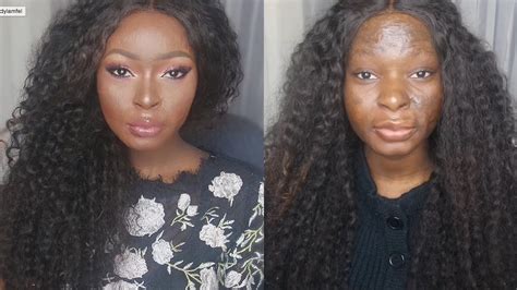 Burn Victim Makeup Transformation | Makeupview.co