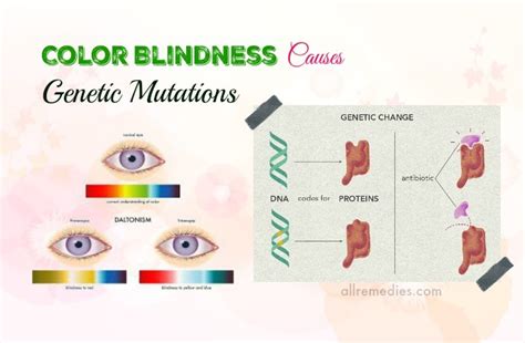 List Of 13 Common Color Blindness Causes, Symptoms, And Effects