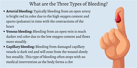 Venous Bleeding