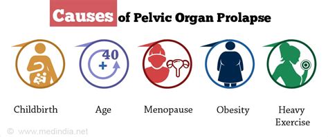 Pelvic Organ Prolapse - Types, Causes, Symptoms, Diagnosis, Treatment & Prevention