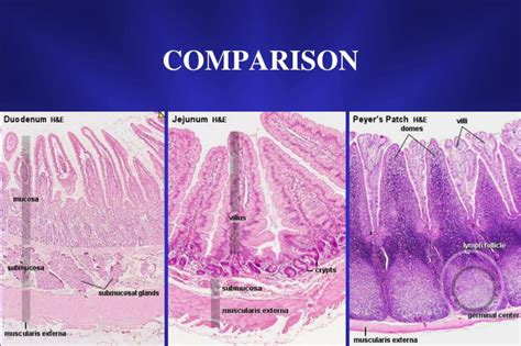 duodenum jejunum ileum comparison - Google Search | Germinal center ...