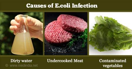 E Coli In Food