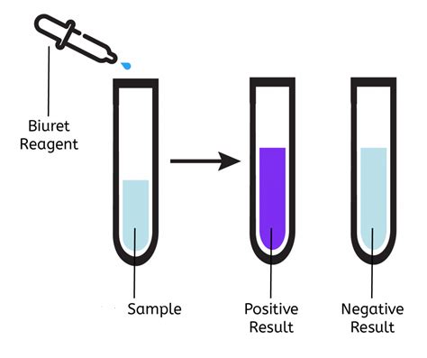 Biuret test: Principle, Reaction, Requirements, Procedure and Result ...