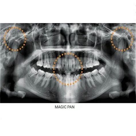 OPG X-Ray Machine, For Radiography, 10 Ma at Rs 1000000 in Kolkata | ID ...