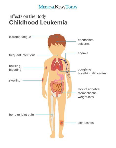 Effects on the body - childhood leukemia infographic | Childhood cancer awareness, Cancer ...