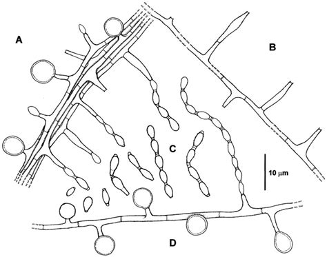 S. chlamydospora IMI 387422. (A) Chlamydospores and phialidic... | Download Scientific Diagram