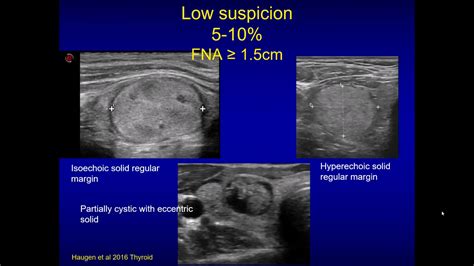 Neck ultrasonography Ct Scan, Sonography, Thyroid Gland, Mohammad ...