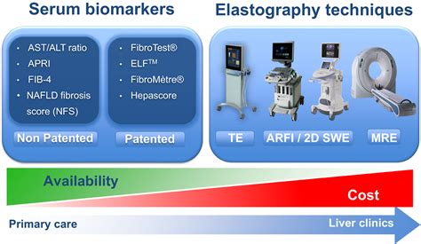 Non‐invasive tests for liver fibrosis in NAFLD: Creating pathways ...