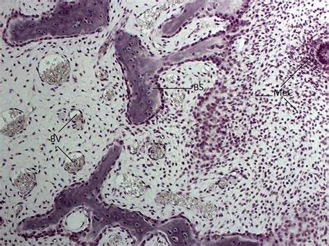 Intramembranous Ossification, 10x (Fixed version) | Histology