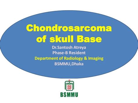 Chondrosarcoma of skull base,Radiology point of view