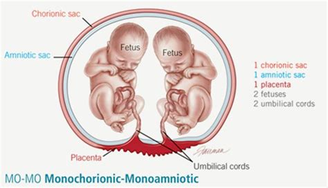 Doctors Warn Canadian Mother About Pregnancy After Receiving Her Ultrasound Results | LifeDaily