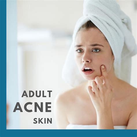 Adult Acne Control Treatment - Beauty Grace