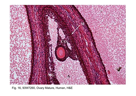 Block14/Fig. 16, 93W7260, Ovary Mature, Human, H&E