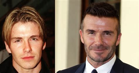 David Beckham Hair Loss: Investigating the Facts – nicehair.org